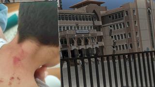 Şanlıurfa'da öğretmen dehşeti! 10 yaşındaki öğrencisini bu hale getirdi