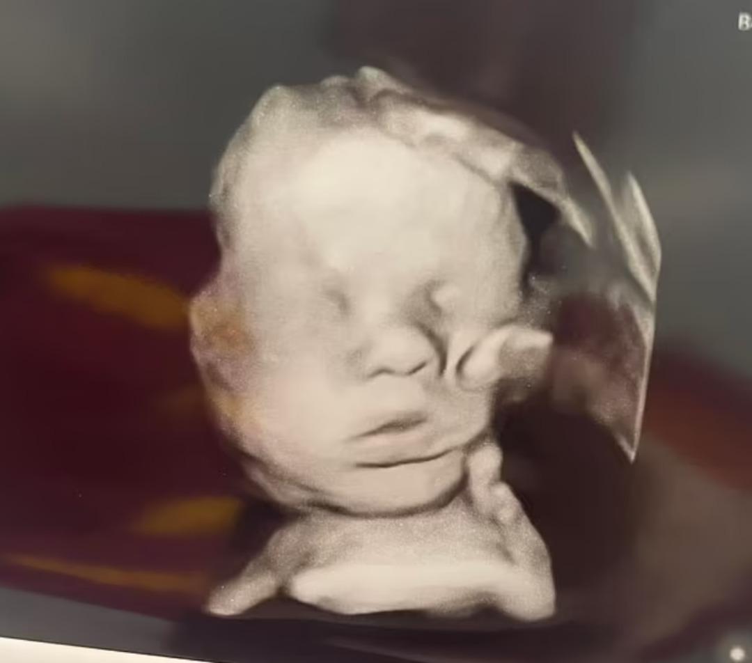 Hamile annenin iddiası olay oldu! Ultrasonda gördüğü şey tartışma yarattı! Gözyaşlarını tutamadı 3