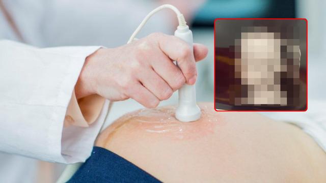Hamile annenin iddiası olay oldu! Ultrasonda gördüğü şey tartışma yarattı! Gözyaşlarını tutamadı