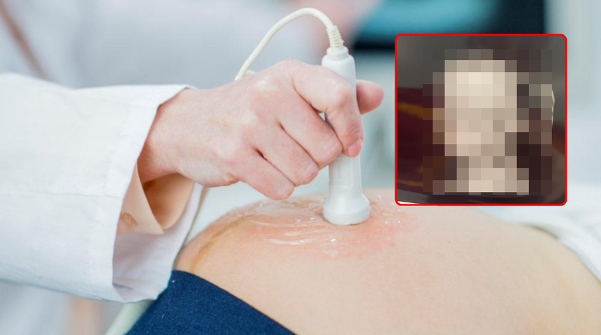 Hamile annenin iddiası olay oldu! Ultrasonda gördüğü şey tartışma yarattı! Gözyaşlarını tutamadı