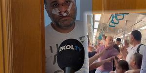 Çocuklarının yanında darbedilen baba konuştu! Olay bakın nasıl başlamış: "Bu konuyu sen fişekledin..."
