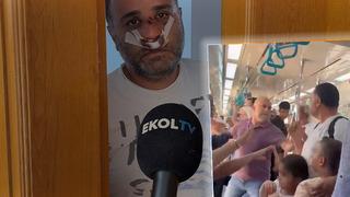 Çocuklarının yanında darbedilen baba konuştu! Olay bakın nasıl başlamış: Bu konuyu sen fişekledin...