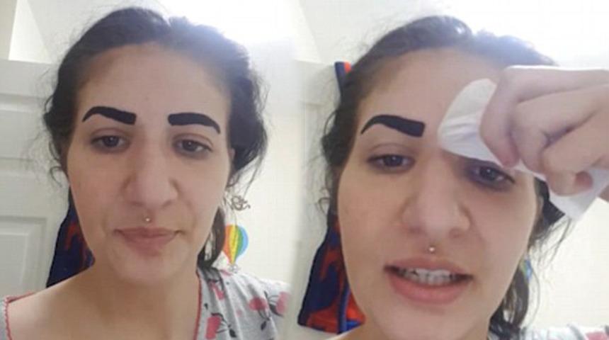  G&uuml;zelleşeyim derken, kaşlarını kaybetti