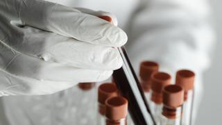 Tıp dünyasında ilk! Yeni kan grubu keşfedildi! Hiçbir testle uyumlu değil...