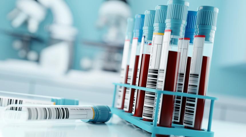 Japon bilim insanlarından tıpta devrim: Kan grubu farkı ortadan kalkıyor! Tüm kan gruplarıyla uyumlu 'yapay kan' geliştirildi