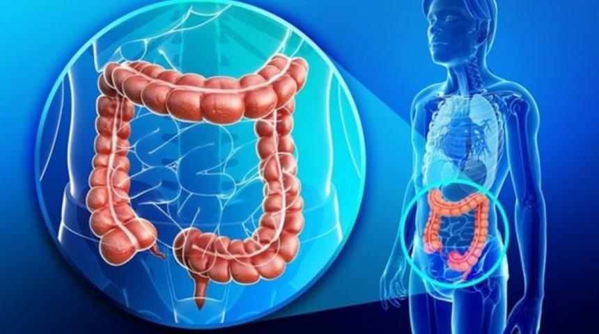 Bu besinler kalın bağırsak kanserine kalkan oluyor