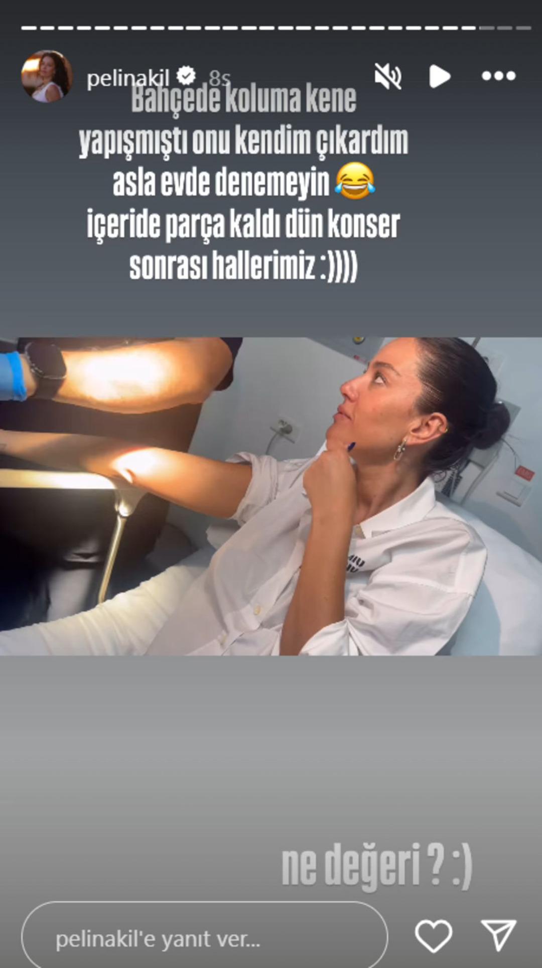 pelin pelin