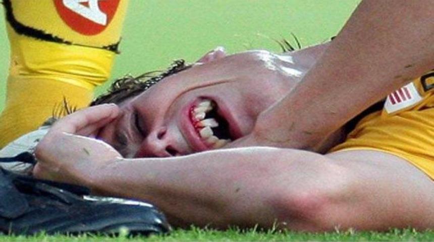 Kafa topuna &ccedil;ıktı, dişleri kırıldı! (VİDEO)