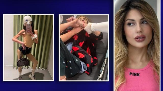 Ailesi '2 kez kalbi durdu' demişti! Nihal Candan 29,5 kiloya kadar düşmüş! Yoğun bakımdan ilk görüntü