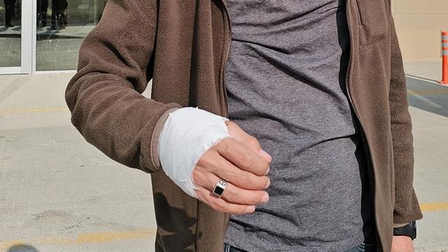 Bakan Memişoğlu açıkladı! Kurban kesimi sırasında binlerce insan yaralandı