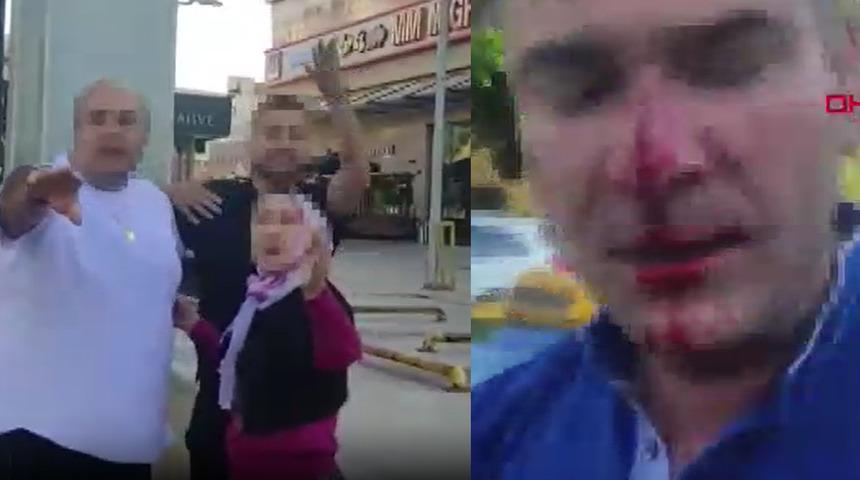 Önce İstanbul şimdi de Ankara... Eşi ve çocuklarının yanında dövüp hastanelik ettiler