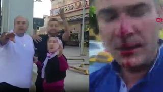 Önce İstanbul şimdi de Ankara... Eşi ve çocuklarının yanında dövüp hastanelik ettiler