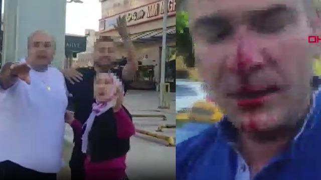 Önce İstanbul şimdi de Ankara... Eşi ve çocuklarının yanında dövüp hastanelik ettiler