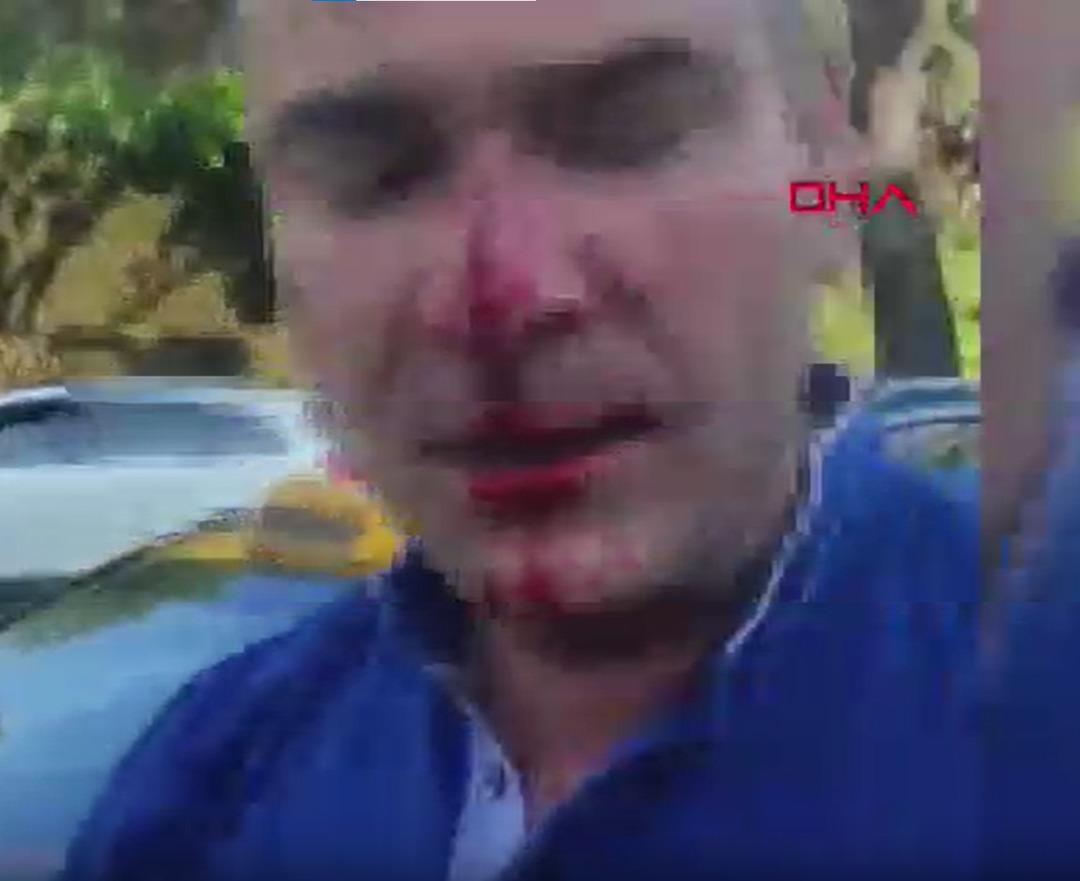 Önce İstanbul şimdi de Ankara... Eşi ve çocuklarının yanında dövüp hastanelik ettiler 2