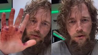 Görenler yakışıklı oyuncuyu tanıyamadı! Yağlı saçları ve sakallarıyla inanılmaz...