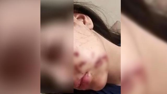 Yer: Siirt! Her şey yolda yürürken bir anda oldu: Bir anlık eğlence kabusa dönüştü