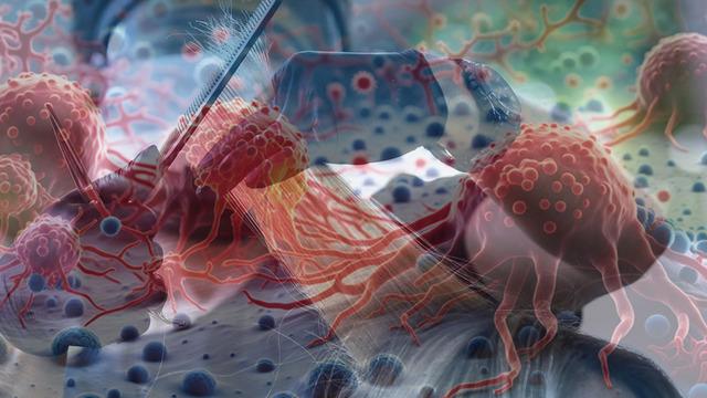 Yeni araştırma: Kanser olma riski en yüksek 6 meslek açıklandı! 