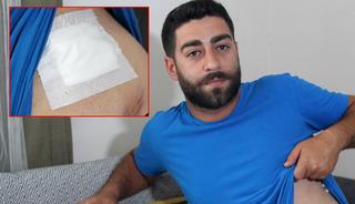 Karnında aniden ağrı hissetti! Gerçek röntgende belli oldu
