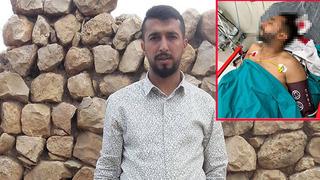 Adana'da hayrete düşüren olay! Döner yerken tavandan düşen kurşunla başından vuruldu