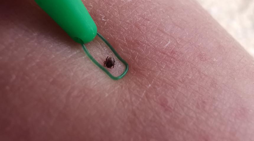 6 can almıştı: Sağlık Bakanlığı'ndan 'Kırım Kongo Kanamalı Ateşi' açıklaması!