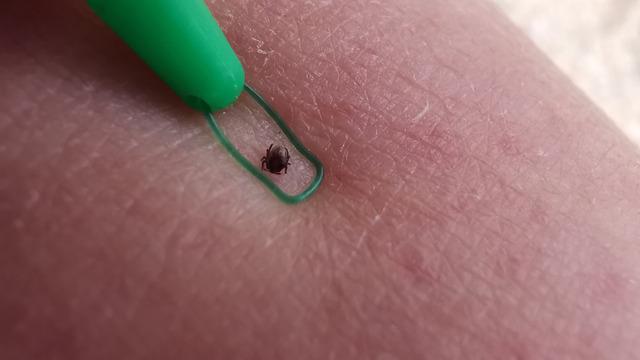 6 can almıştı: Sağlık Bakanlığı'ndan 'Kırım Kongo Kanamalı Ateşi' açıklaması!