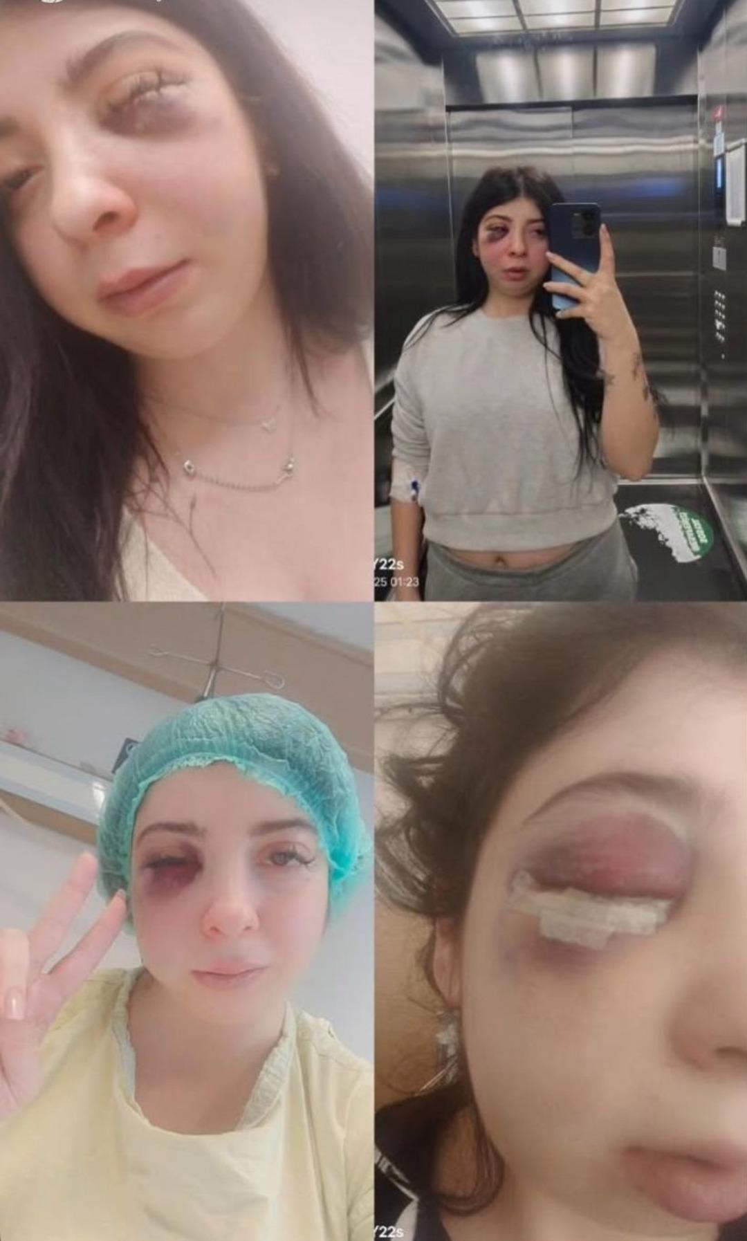 Sokak ortasında darp etmişti! Pişkin savunma: "Amacım sadece..." 3