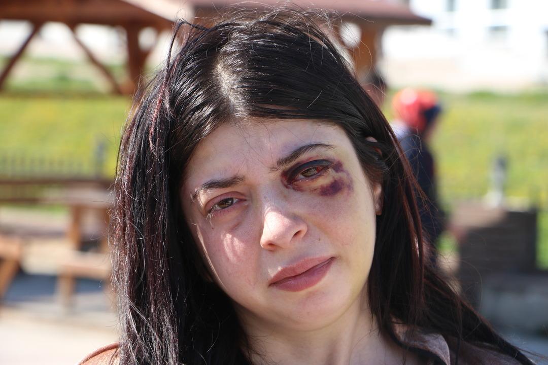 Sokak ortasında darp etmişti! Pişkin savunma: "Amacım sadece..." 1