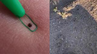 Dikkat çeken görüntü! Kene bir vatandaşı resmen kovaladı! Mutasyona mı uğramış?