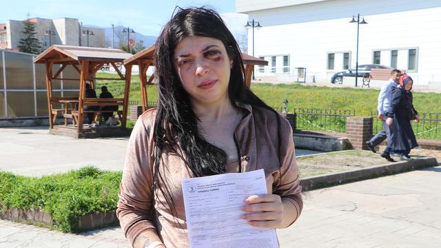 Sokak ortasında darp etmişti! Pişkin savunma: Amacım sadece...