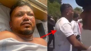 Parçalanan uçaktan yürüyerek çıkmıştı! Nasıl sağ kurtulduğunu anlattı! 11A'nın sırrı...