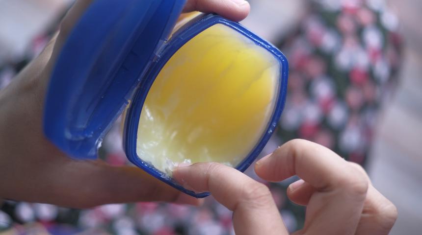 Vazelinin faydaları nelerdir? Vazelin neye iyi gelir, ayak mantarına iyi gelir mi?