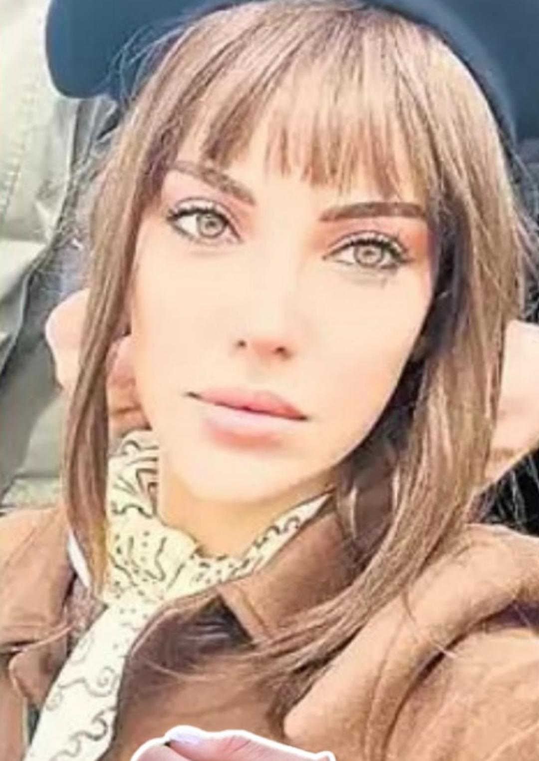 Tuvana Türkay ın estetik değişimi yine gündemde: Son olarak yüz gerdirme operasyonu geçirdi! 2