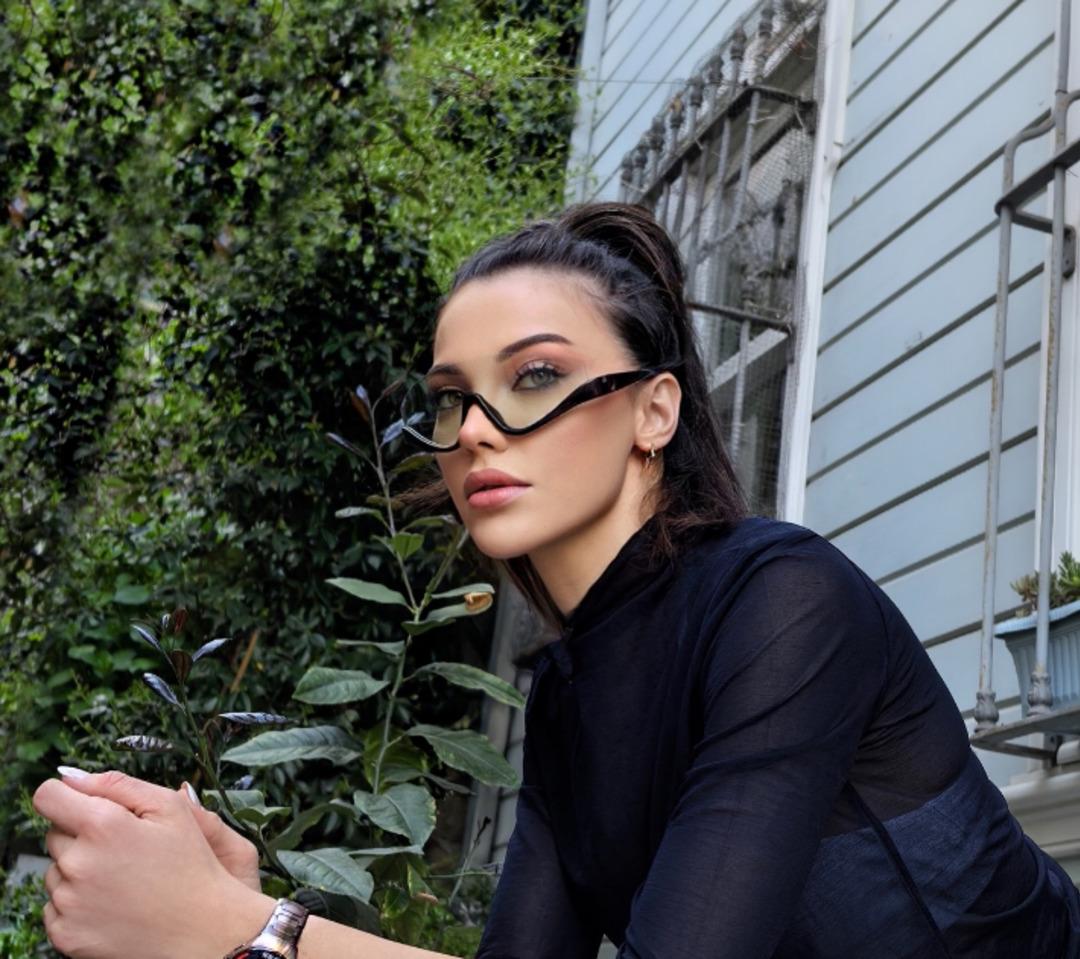Tuvana Türkay ın estetik değişimi yine gündemde: Son olarak yüz gerdirme operasyonu geçirdi! 3
