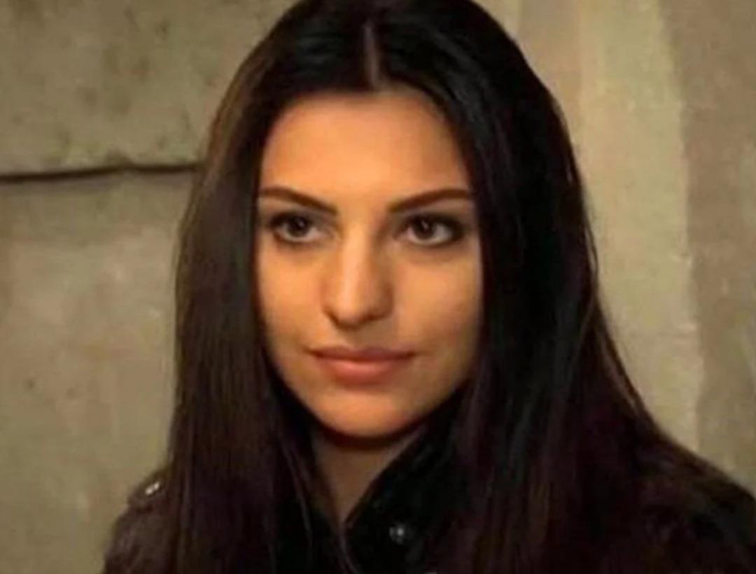 Tuvana Türkay ın estetik değişimi yine gündemde: Son olarak yüz gerdirme operasyonu geçirdi! 1