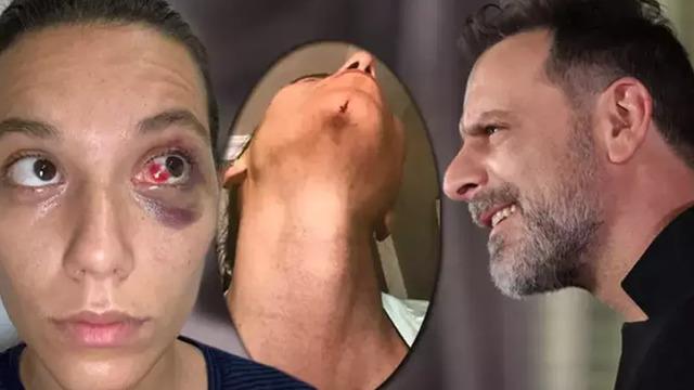 Ozan Güven'e hapis cezası... Ozan Güven eski sevgilisi Deniz Bulutsuz'u darp etmekle suçlanıyordu! 