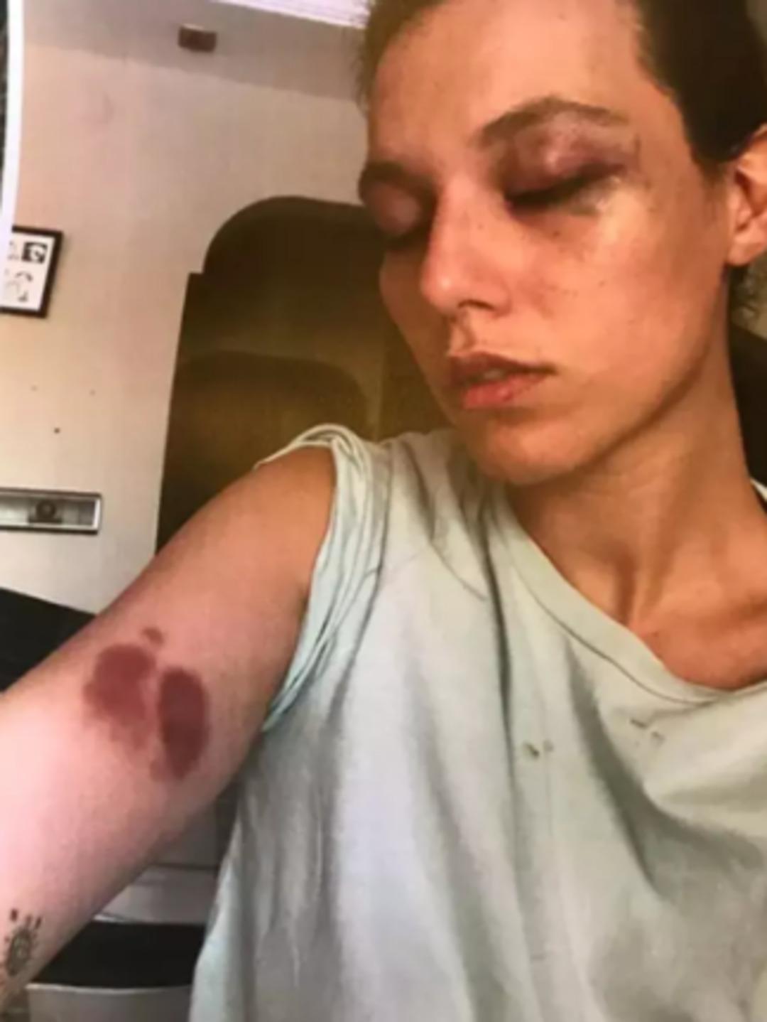 Ozan Güven e hapis cezası... Ozan Güven eski sevgilisi Deniz Bulutsuz u darp etmekle suçlanıyordu!  1