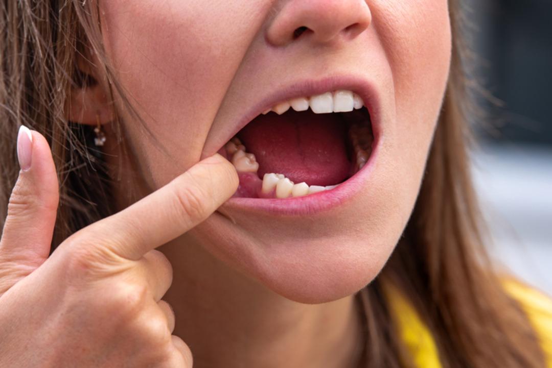 iStock-1284090892