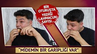 İştahı hiç bitmiyor, hatta yedikçe daha da acıkıyor! Midemin bir garipliği var