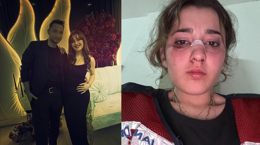 Nişanlı çiftin tatili kabusa döndü! Plajda kafa atıp, motosiklet kaskıyla dövdü