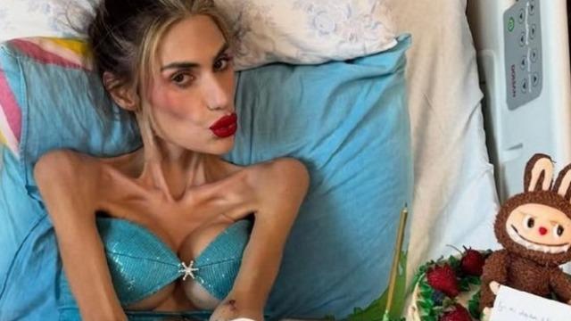 Nihal Candan 23 kiloya kadar düştü! Tüm organları iflas etti! Son hali üzdü! 'Ölümle karşı karşıya'