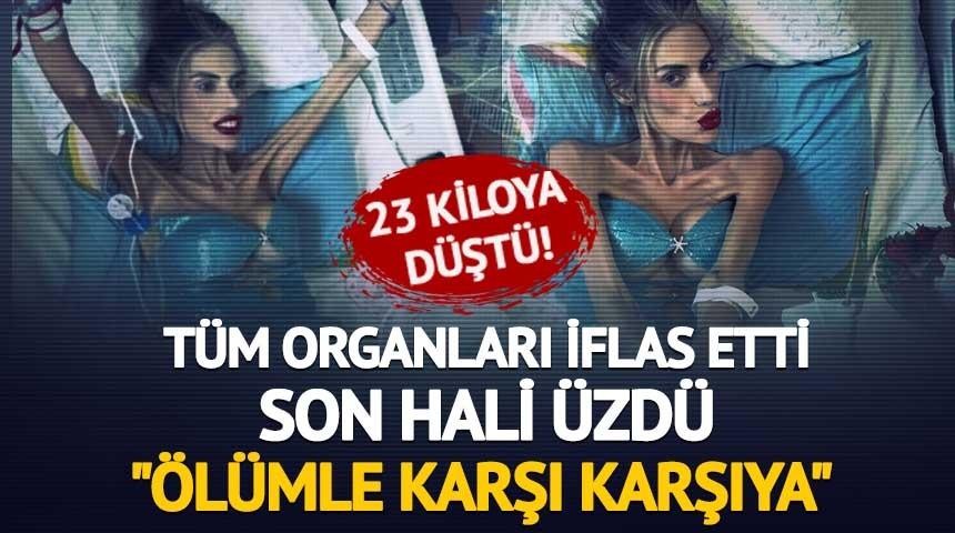 Nihal Candan 23 kiloya kadar düştü! Tüm organları iflas etti! Son hali üzdü! 'Ölümle karşı karşıya'