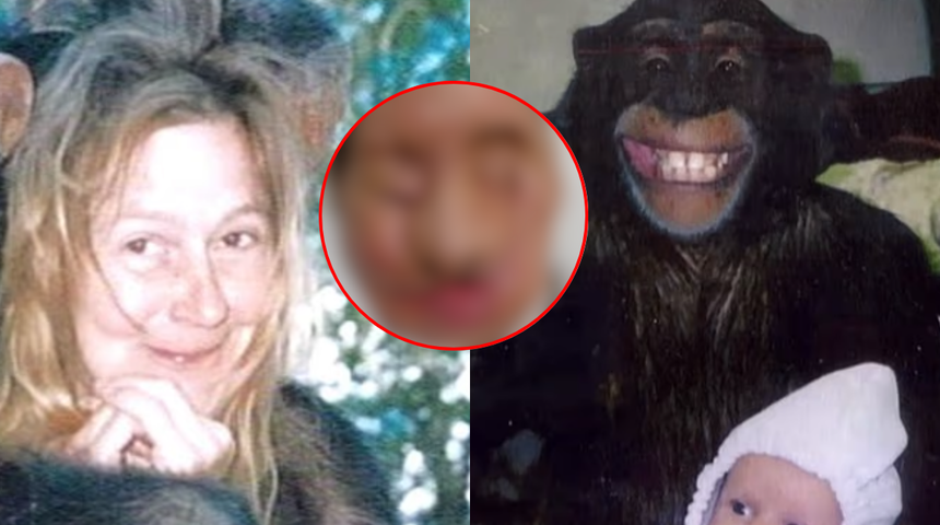 Şempanze yüzünü parçalamıştı! Yüz nakli olan kadın son halini yıllar sonra gösterdi