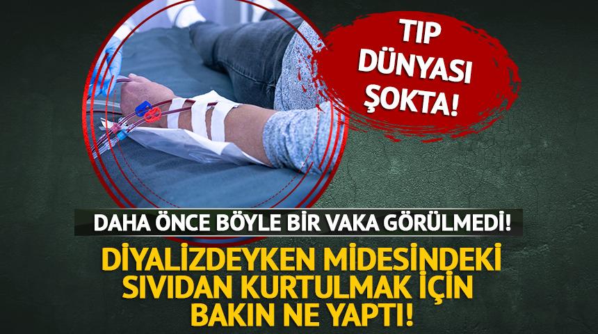 Diyalizdeyken midesindeki sıvıdan kurtulmak için bakın ne yedi!