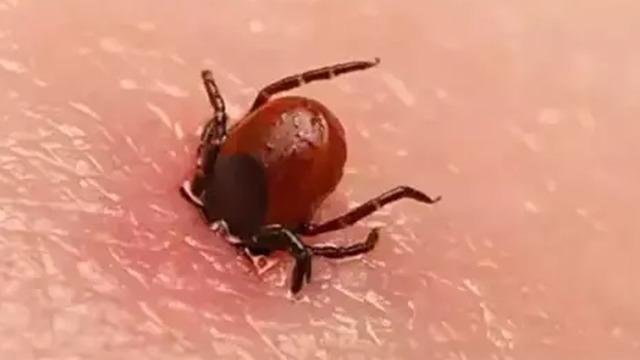 Kene; elle tutup çekilmez, tırnakla ezilmez! Yüzde 100 bulaşma riski var! 4 kişi hayatını kaybetti: Özelliklere vücutta bu bölgelere yapışıyor