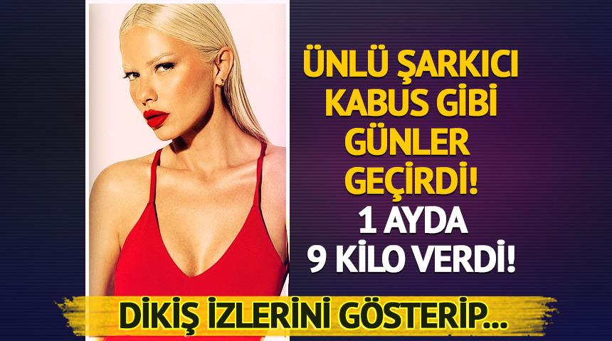Kabus gibi günler geçirdi! 1 ayda 9 kilo verdi...
