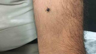 Yine Kayseri, yine kene vakası! Tedavisi yapılan hasta, gözetim altına alındı