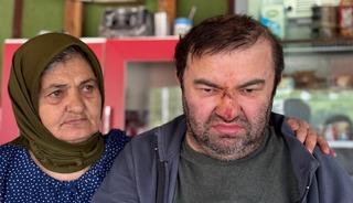 Yer: Bolu... Korkunç olay: Yüzde 90 engelli adama öldüresiye dayak! 