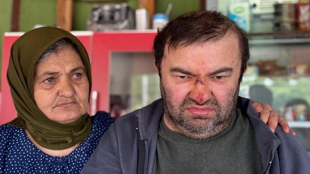 Yer: Bolu... Korkunç olay: Yüzde 90 engelli adama öldüresiye dayak! 