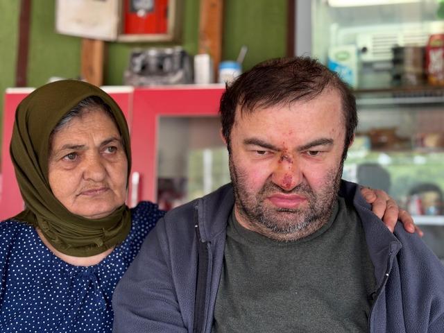 Yer: Bolu... Korkunç olay: Yüzde 90 engelli adama öldüresiye dayak!
