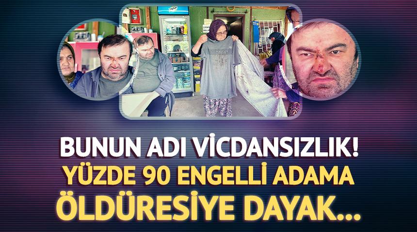 Yer: Bolu... Korkunç olay: Yüzde 90 engelli adama öldüresiye dayak! 